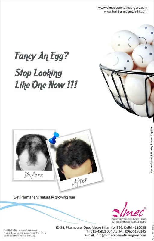 Olmec — “Fancy an egg? Stop looking like one now!!!” — hair transplant clinic